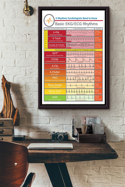 Rhythms Cardiologists Knowledge Basic Ekgecg Rhythms Poster - Fitness Wall Art - Gift For Gymer Fitness Cardiologist Framed Matte Canvas Framed Prints, Canvas
