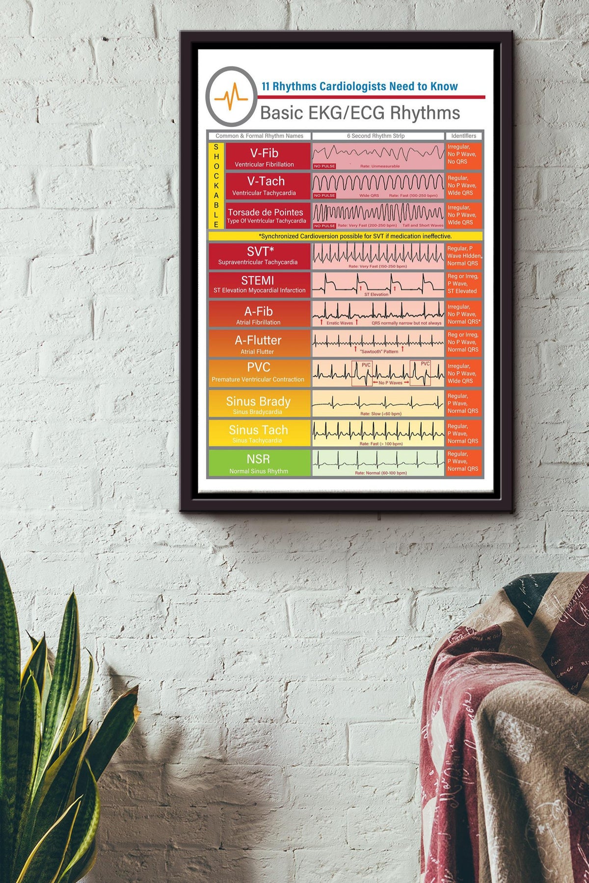 Rhythms Cardiologists Knowledge Basic Ekgecg Rhythms Poster - Fitness Wall Art - Gift For Gymer Fitness Cardiologist Framed Matte Canvas Framed Prints, Canvas