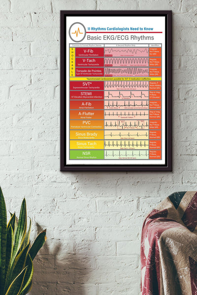 Rhythms Cardiologists Knowledge Basic Ekgecg Rhythms Poster - Fitness Wall Art - Gift For Gymer Fitness Cardiologist Framed Matte Canvas Framed Prints, Canvas