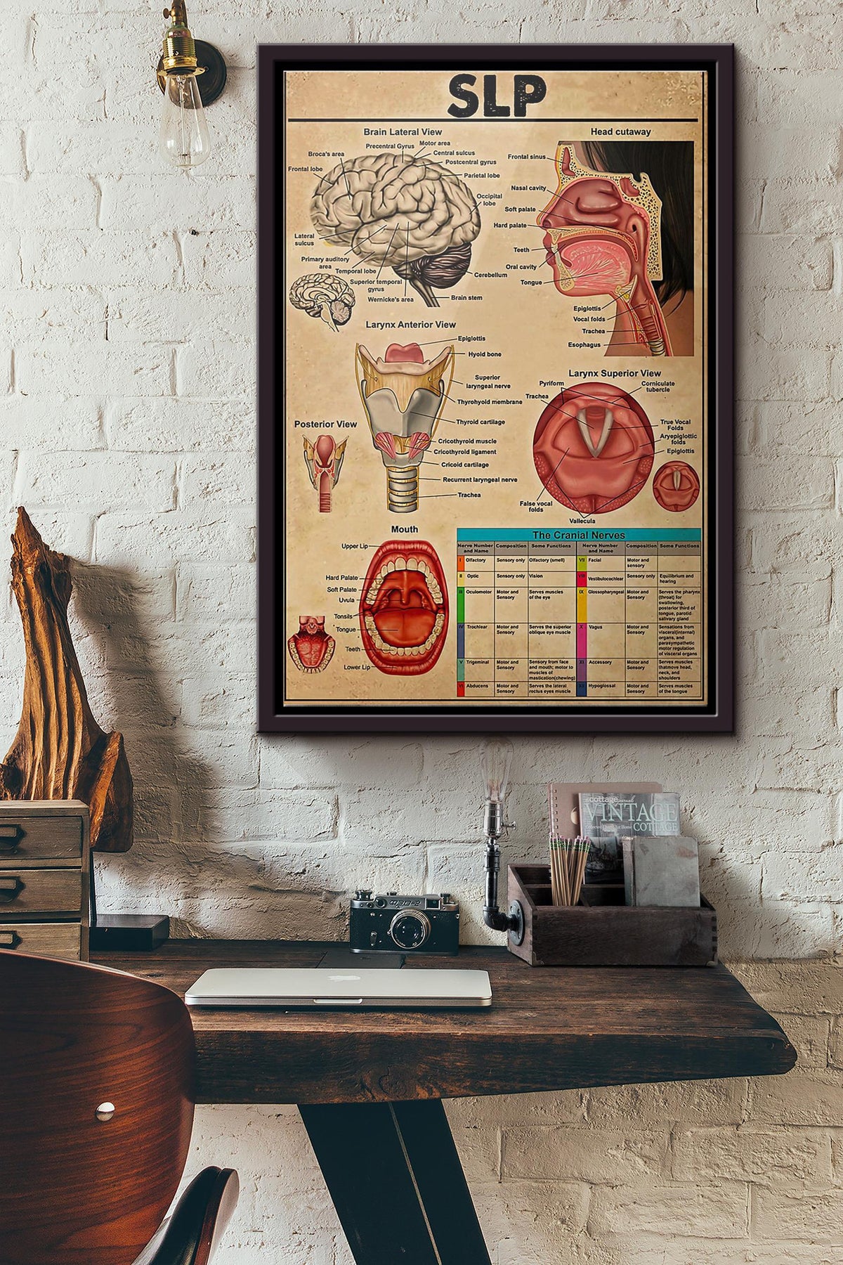 Speech Language Pathologists Slp Knowledge Poster Framed Matte Canvas