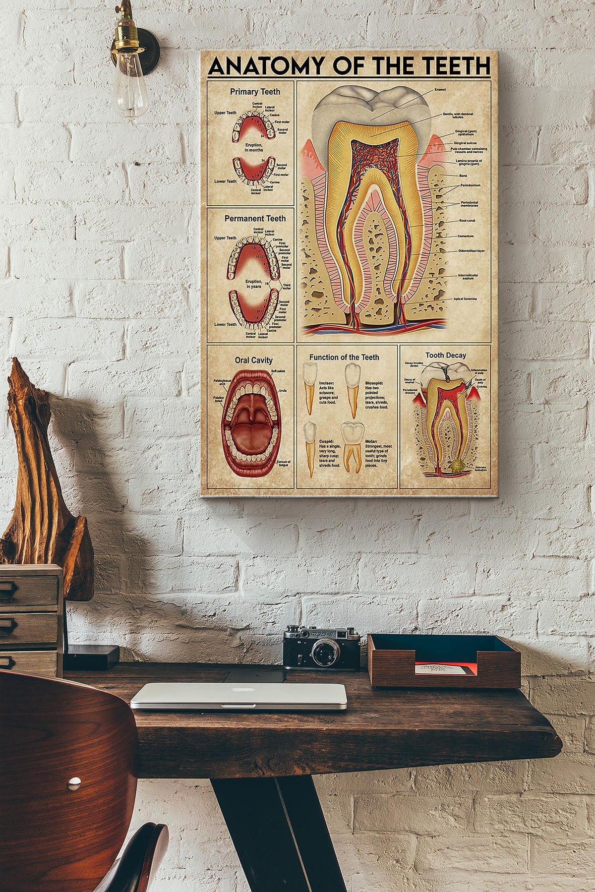 Anatomy Of The Teeth Denist Poster Canvas Gallery Wrapped Canvas Framed Gift Idea