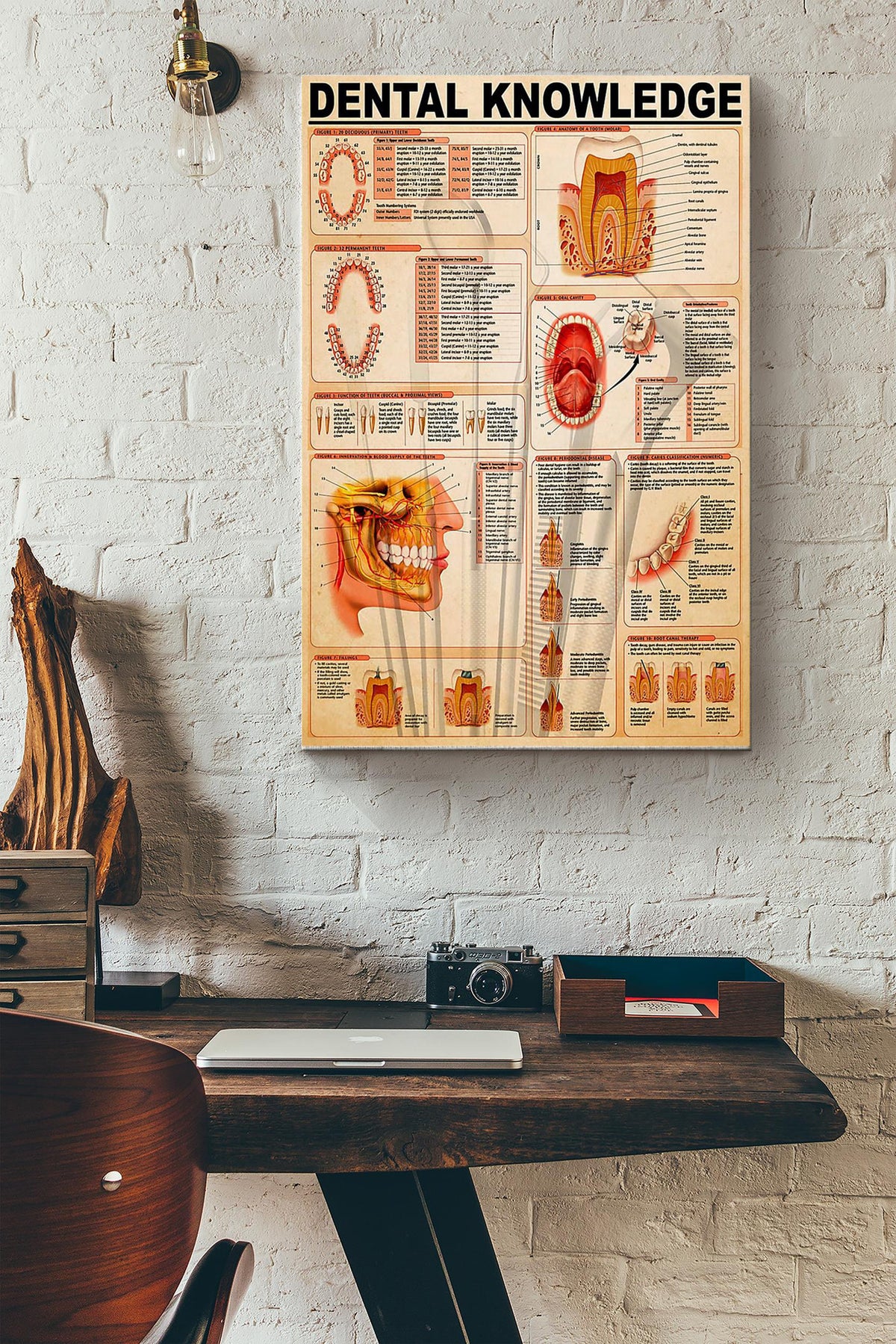 Dental Knowledge Things You Need To Know About Dental Dentist Poster Canvas Gallery Wrapped Canvas Framed Gift Idea