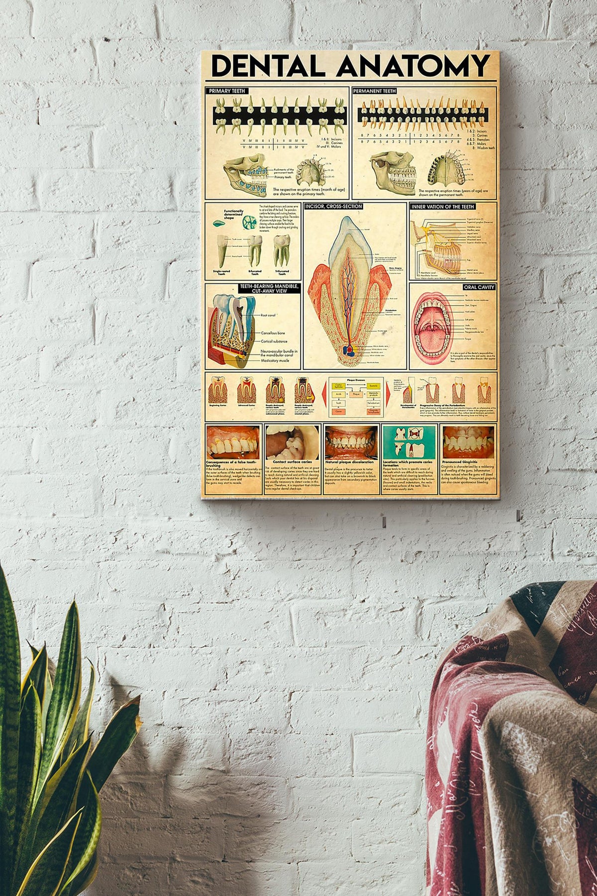 Dental Anatomy Inforgraphy Dentist Poster Canvas Gallery Wrapped Canvas Framed Gift Idea