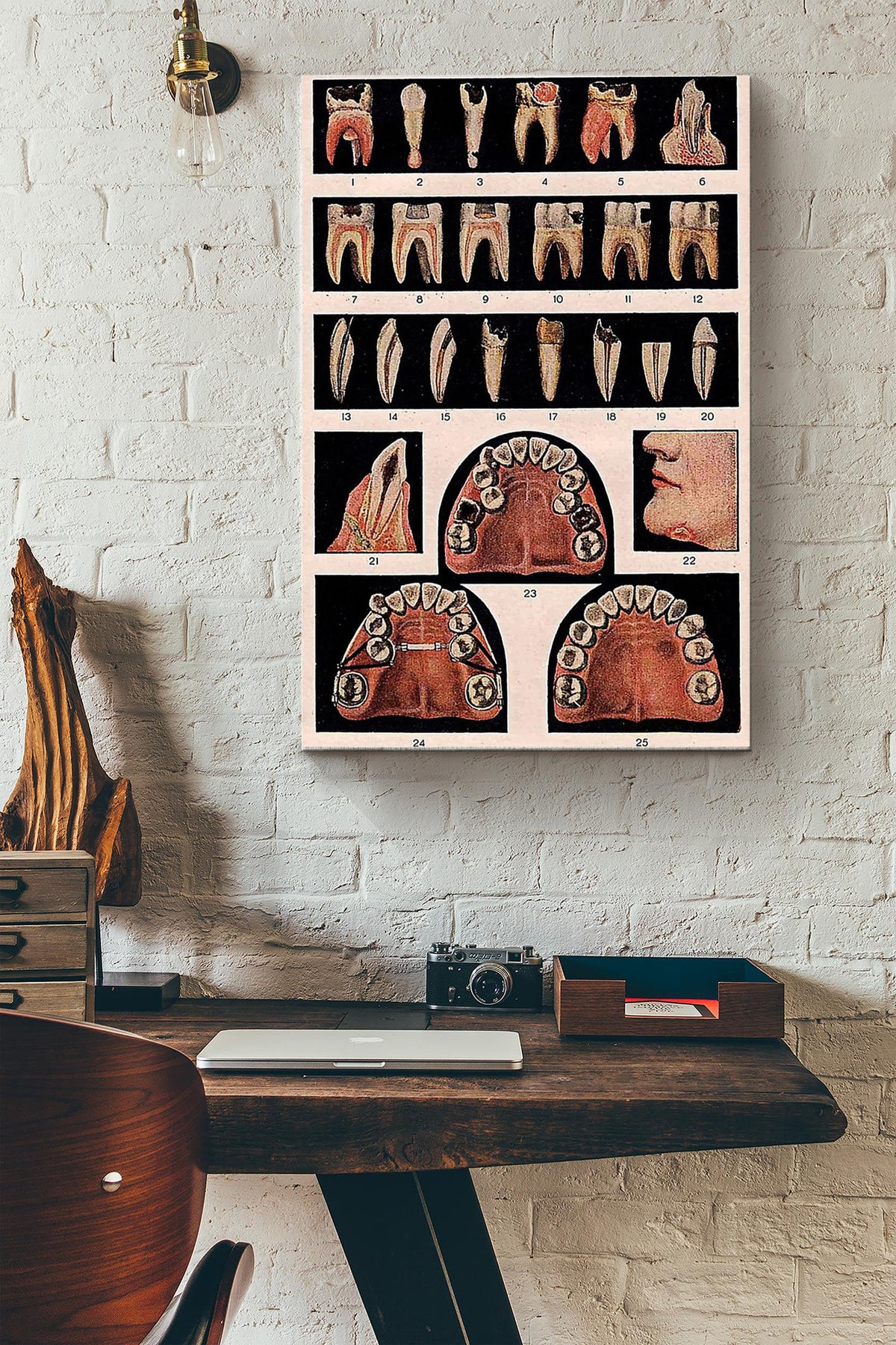 Full Number Of Teeth Teeth Anatomy Dentist Poster Canvas Gallery Wrapped Canvas Framed Gift Idea