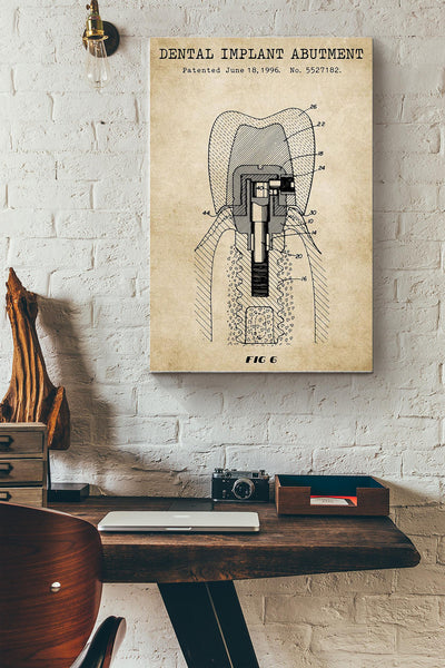 Dental Implant Abutment Poster Canvas Gallery Wrapped Canvas Framed Gift Idea