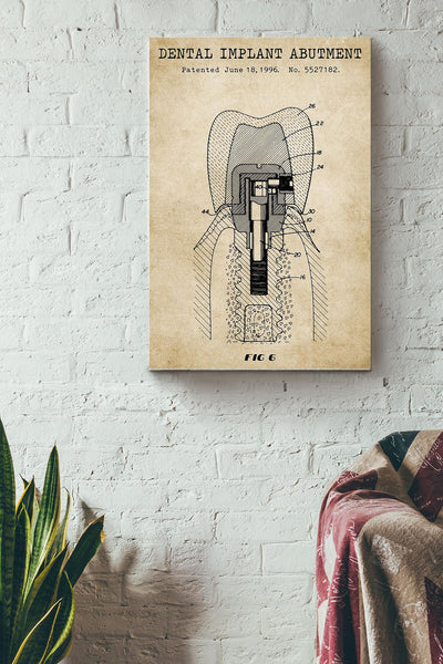 Dental Implant Abutment Poster Canvas Gallery Wrapped Canvas Framed Gift Idea