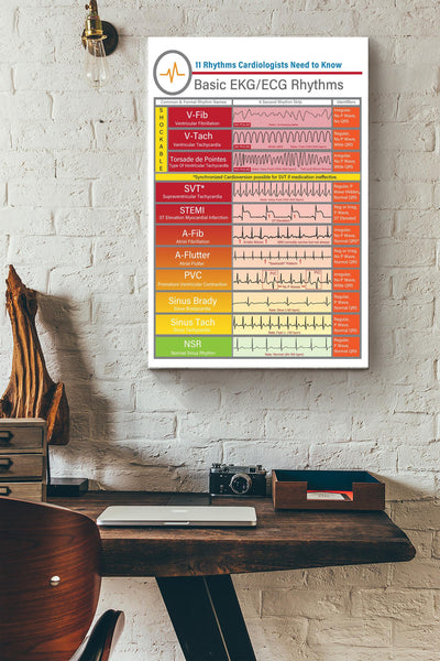 Rhythms Cardiologists Knowledge Basic Ekgecg Rhythms Poster - Fitness Wall Art - Gift For Gymer Fitness Cardiologist Canvas Gallery Wrapped Canvas Framed Gift Idea Framed Prints, Canvas