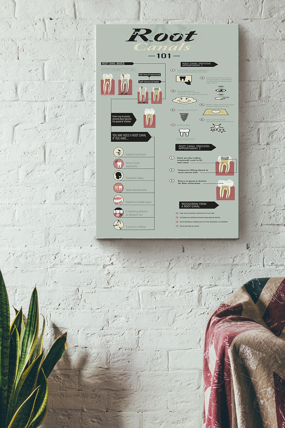 Root Canals 101 Dentist Poster Canvas Gallery Wrapped Canvas Framed Gift Idea