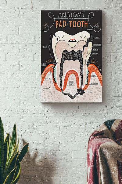Anatomy Of A Bad Tooth Denist Poster Canvas Gallery Wrapped Canvas Framed Gift Idea