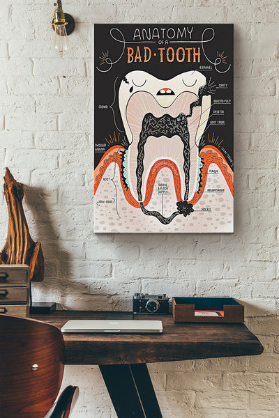 Anatomy Of A Bad Tooth Denist Poster Canvas Gallery Wrapped Canvas Framed Gift Idea