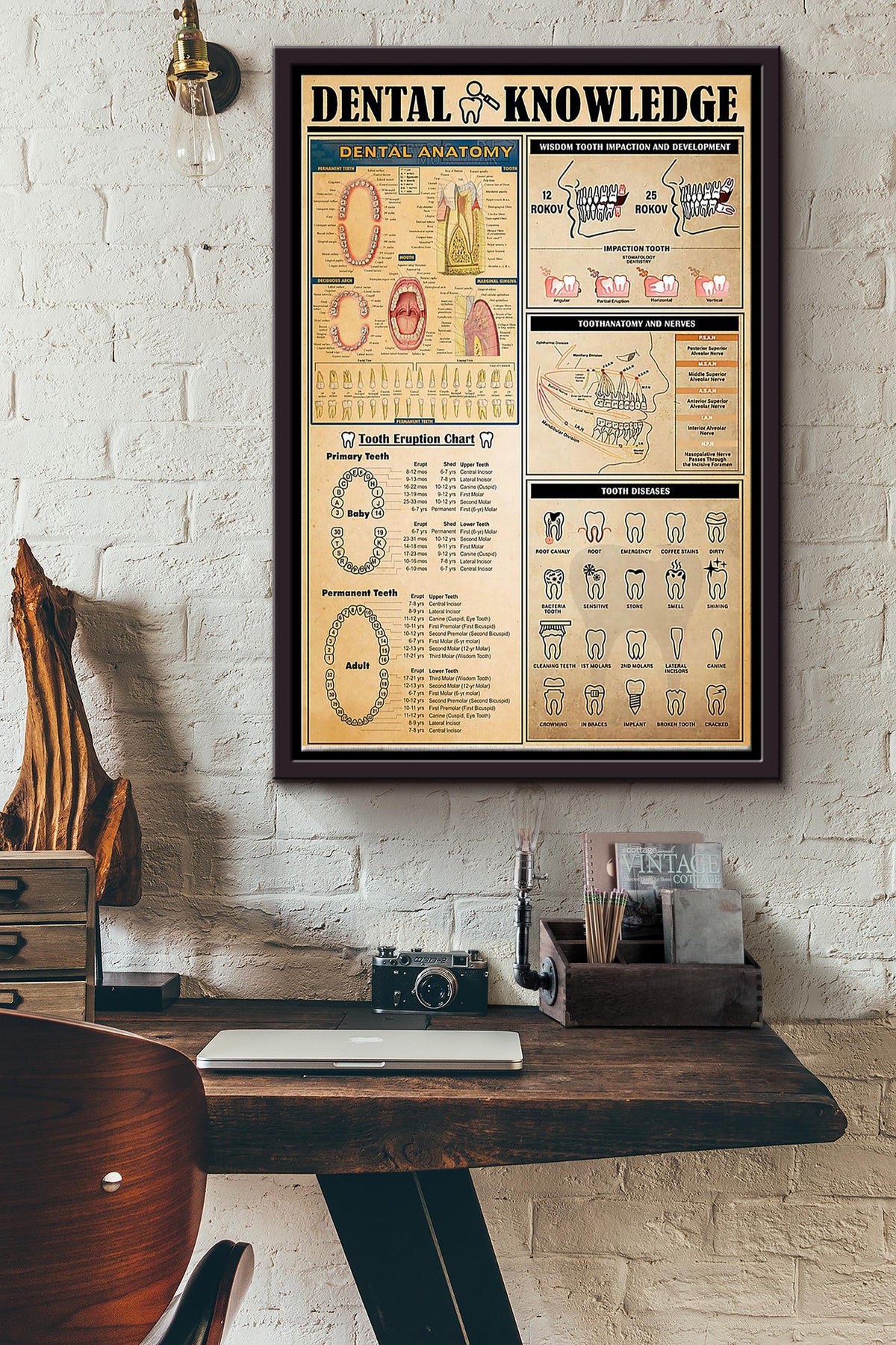 Dental Knowledge Things You Need To Know About Dental Poster Framed Matte Canvas