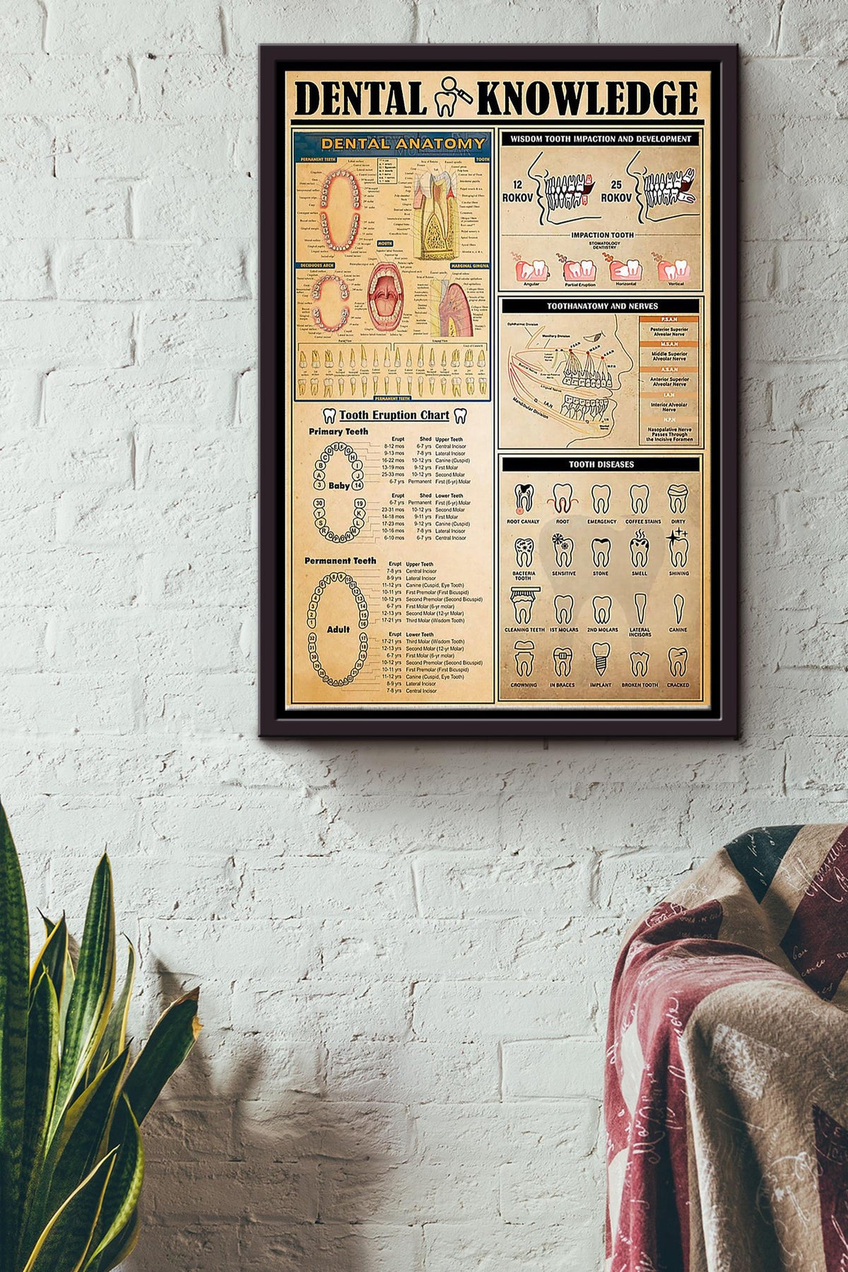 Dental Knowledge Things You Need To Know About Dental Poster Framed Matte Canvas
